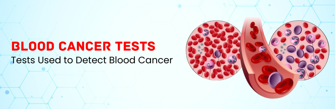 Which Tests are Used to Detect Blood Cancer